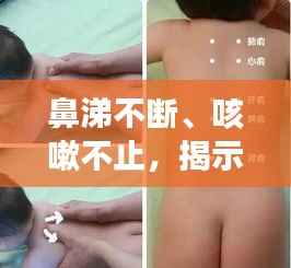鼻涕不断、咳嗽不止,揭示症状背后的健康隐患